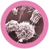 Breast Cancer | Malignant neoplasm