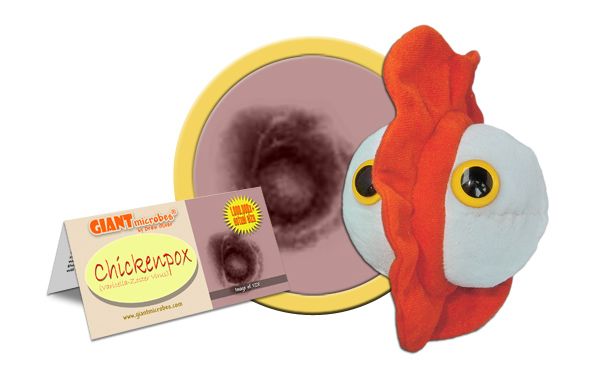Chickenpox | Varicella-Zoster virus