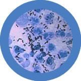 Clap - Gonorrhea | Neisseria gonorrhoeae