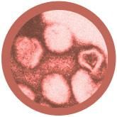 Rubella | Rubella virus