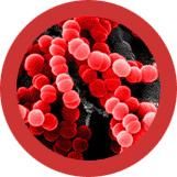 Sore Throat | Streptococcus