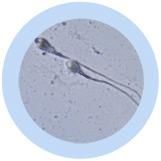 Sperm Cell | Spermatozoon
